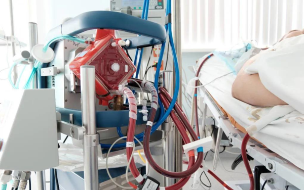 熱點 | 填補國產(chǎn)空白，ECMO迎來“中國造”