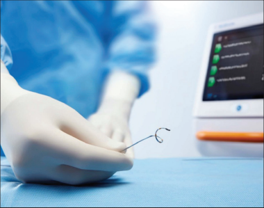  RDN | 經(jīng)腎動脈去交感神經(jīng)術(shù)——高血壓微創(chuàng)介入治療